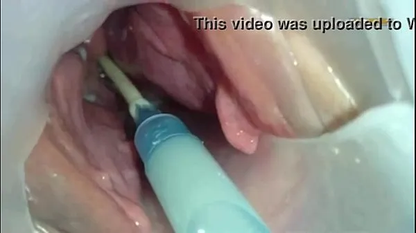 Big Sperm injected into the uterus of the wife of others total Videos
