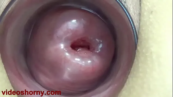 Big Uterus Penetration with Objects, Pumping Cervix Prolapse total Videos