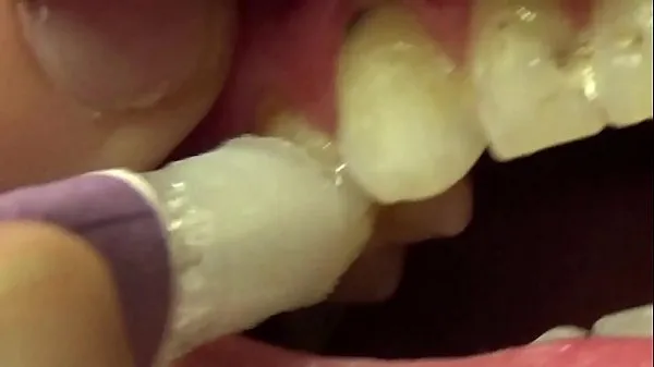 Veľký celkový počet videí: Applying Whitening Paste To Her Filthy Teeth