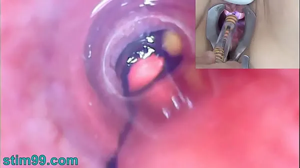 Big Mature Woman Peehole Endoscope Camera in Bladder with Balls total Videos