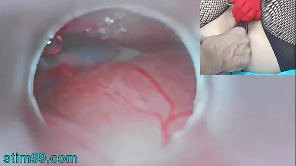 Big Uncensored Japanese Insemination with Cum into Uterus and Endoscope Camera by Cervix to watch inside womb total Videos